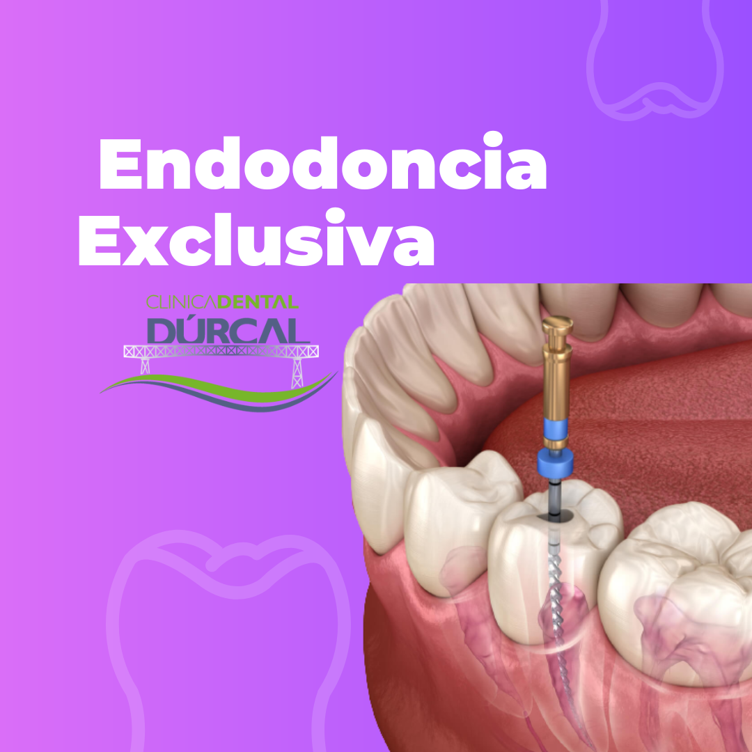 Endodoncia Exclusiva clinica dental durcal