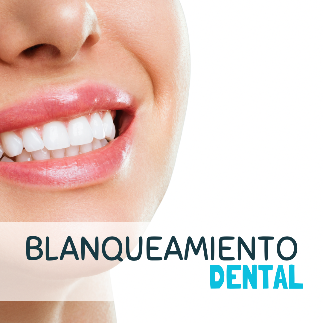 original 1C8BD325 38CB 46A4 A17A F65100BD05AE