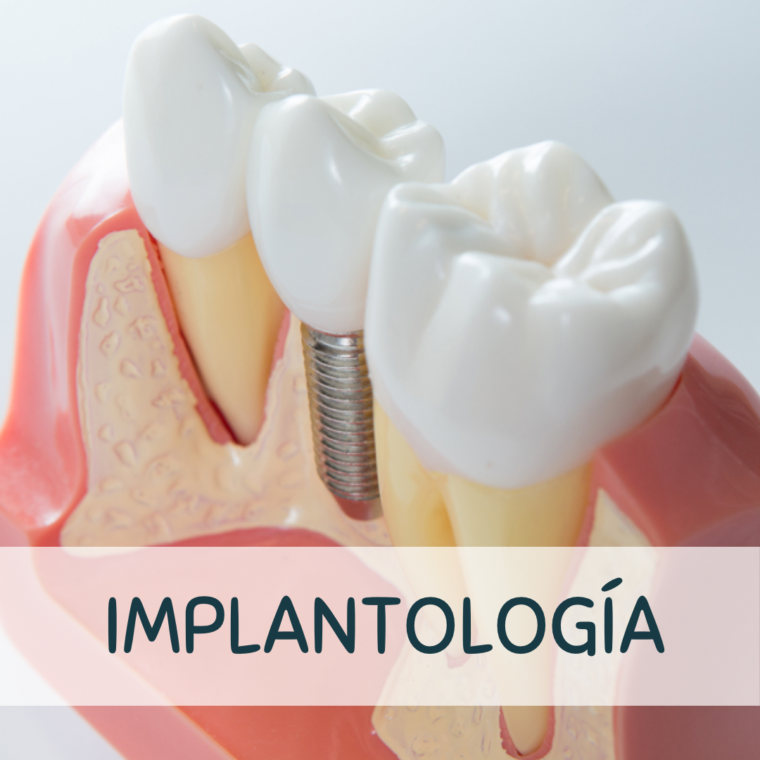 original 6131F27F 9A1F 4001 8264 BF8429497FEF