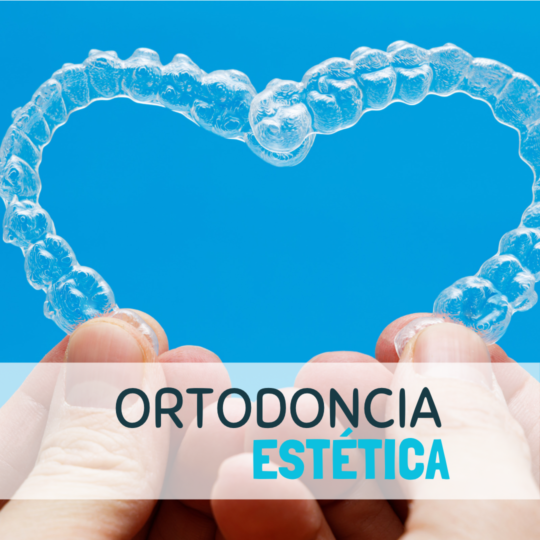 original A5CE1D9F 1AEA 499E A45F 2132847DB882